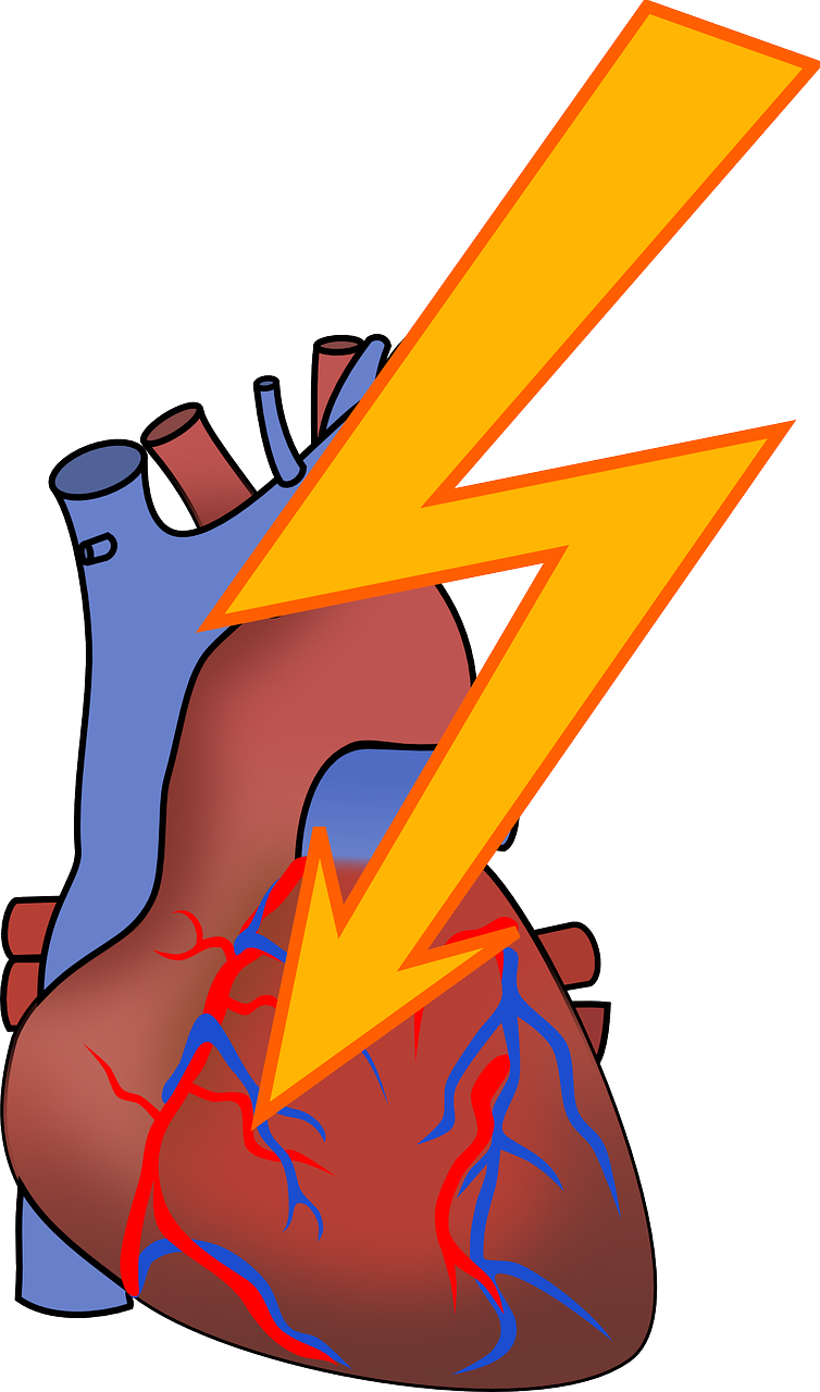Heart Attack
